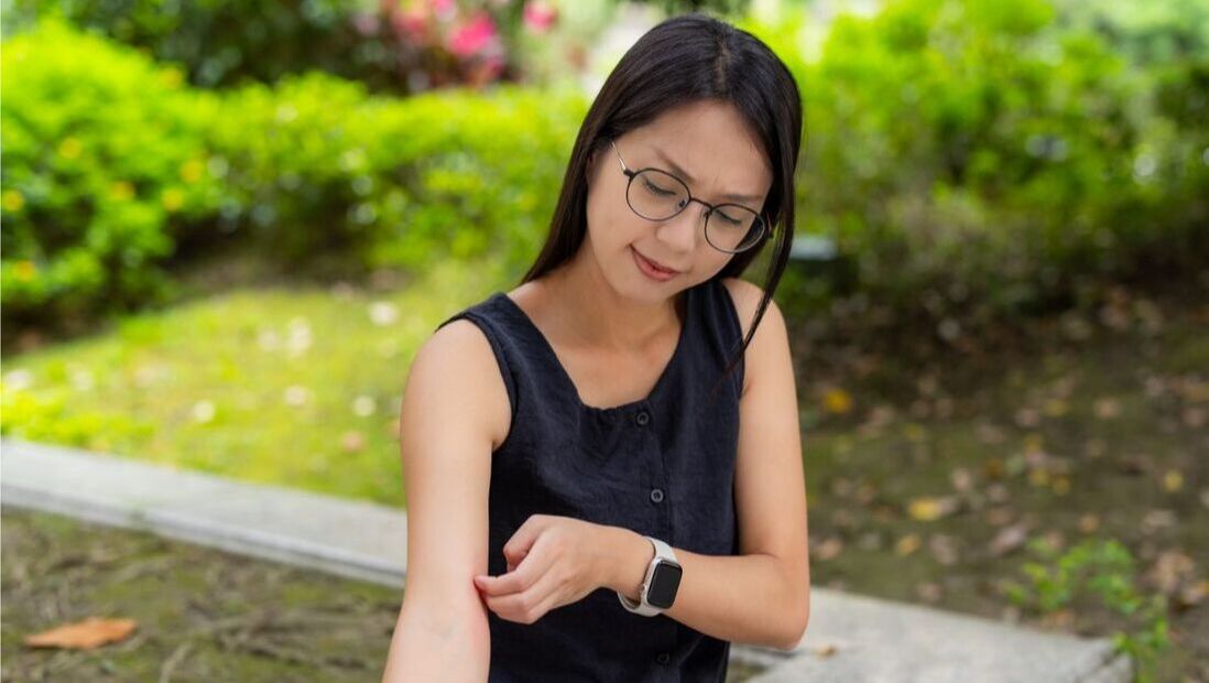 Chinese woman scratching arm that is itchy from a mosquito bite